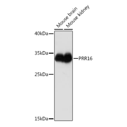 Western Blot - Anti-PRR16 Antibody (A93117) - Antibodies.com