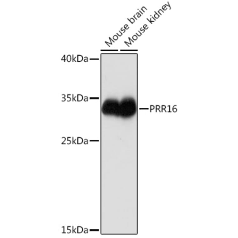 Western Blot - Anti-PRR16 Antibody (A93117) - Antibodies.com