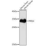 Western Blot - Anti-PRR16 Antibody (A93117) - Antibodies.com