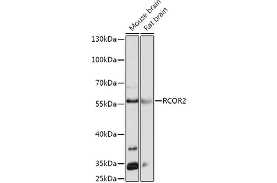 Western Blot - Anti-CoREST2/RCOR2 Antibody (A93122) - Antibodies.com