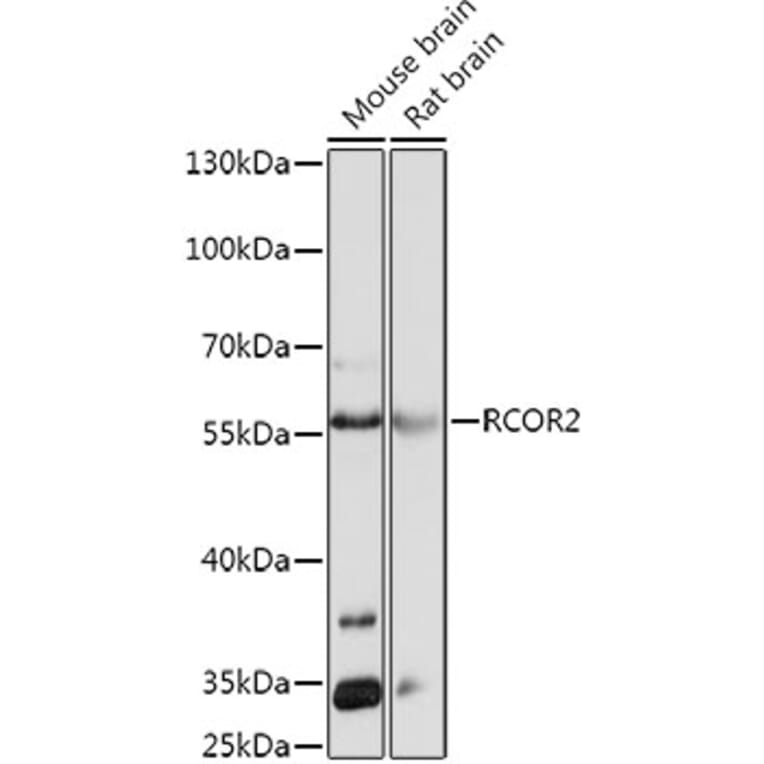Western Blot - Anti-CoREST2/RCOR2 Antibody (A93122) - Antibodies.com
