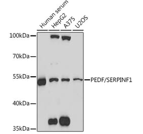 Western Blot - Anti-PEDF Antibody (A93125) - Antibodies.com