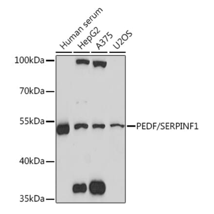 Western Blot - Anti-PEDF Antibody (A93125) - Antibodies.com