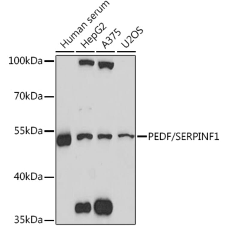 Western Blot - Anti-PEDF Antibody (A93125) - Antibodies.com