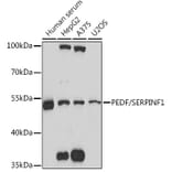 Western Blot - Anti-PEDF Antibody (A93125) - Antibodies.com