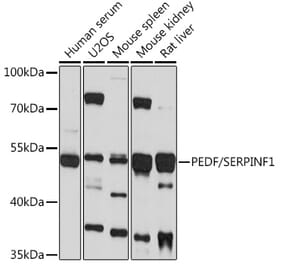 Western Blot - Anti-PEDF Antibody (A93126) - Antibodies.com