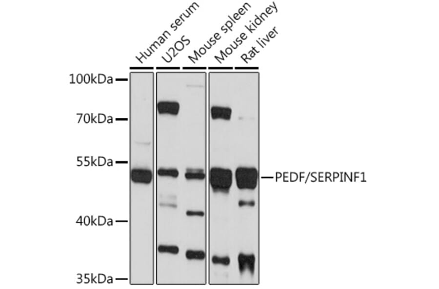 Western Blot - Anti-PEDF Antibody (A93126) - Antibodies.com