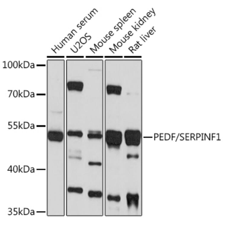 Western Blot - Anti-PEDF Antibody (A93126) - Antibodies.com