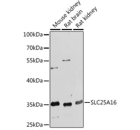 Western Blot - Anti-GDA Antibody (A93128) - Antibodies.com