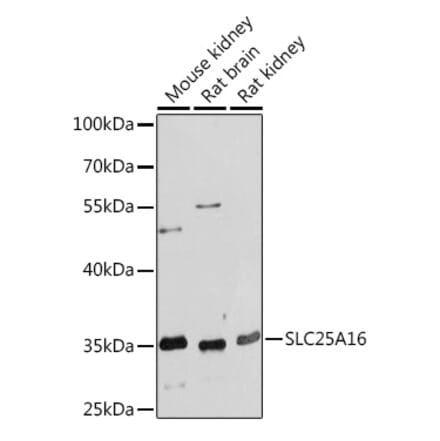 Western Blot - Anti-GDA Antibody (A93128) - Antibodies.com