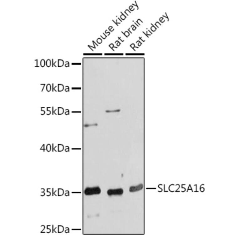 Western Blot - Anti-GDA Antibody (A93128) - Antibodies.com