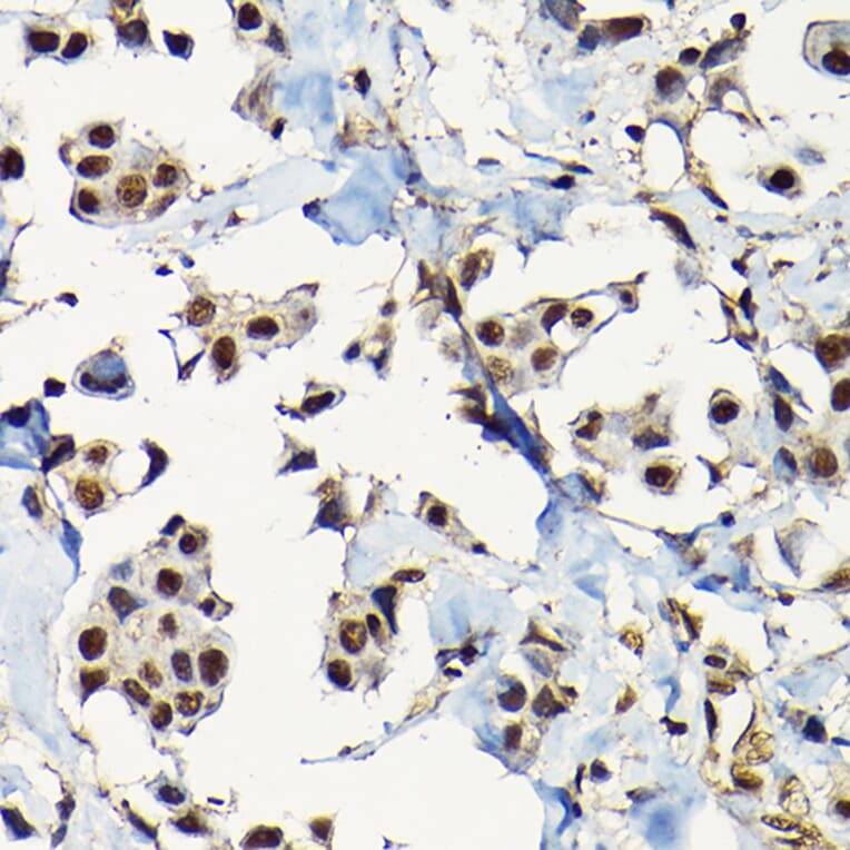 Immunohistochemistry - Anti-Smad2 Antibody (A93131) - Antibodies.com