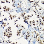 Immunohistochemistry - Anti-Smad2 Antibody (A93131) - Antibodies.com