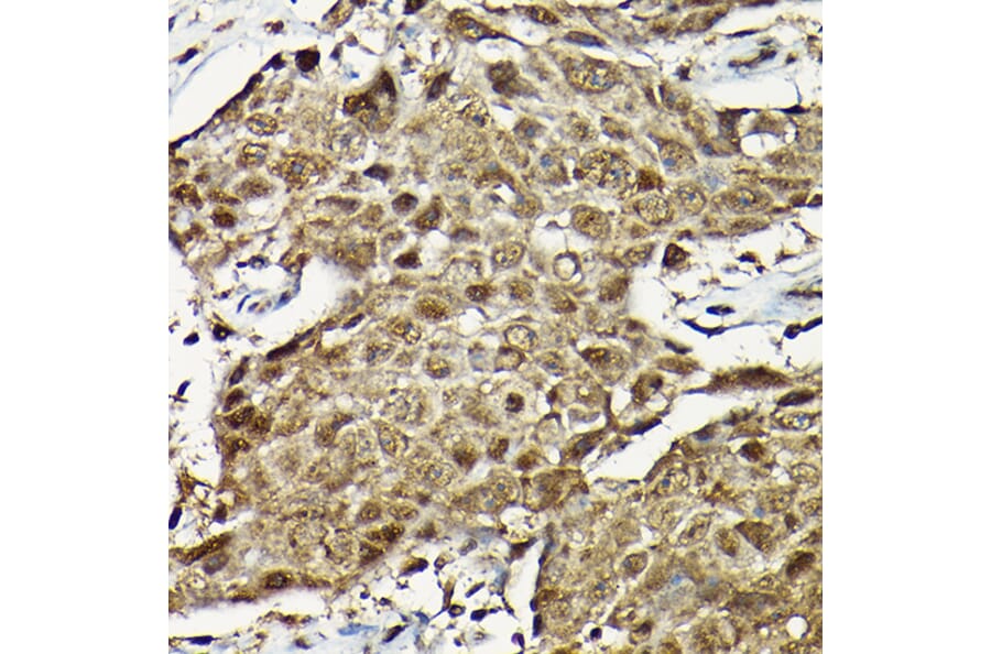 Immunohistochemistry - Anti-Smad2 Antibody (A93131) - Antibodies.com