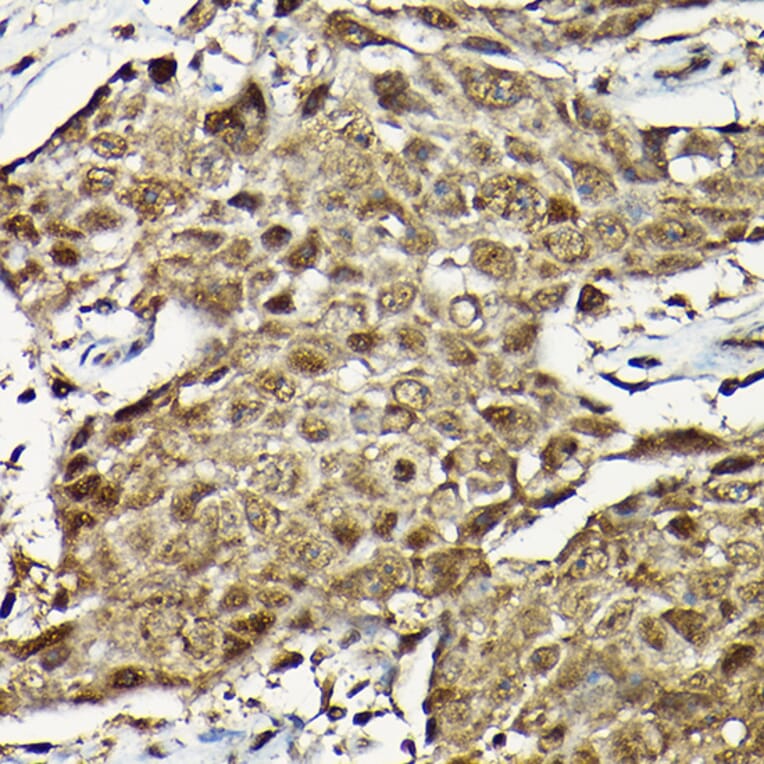 Immunohistochemistry - Anti-Smad2 Antibody (A93131) - Antibodies.com