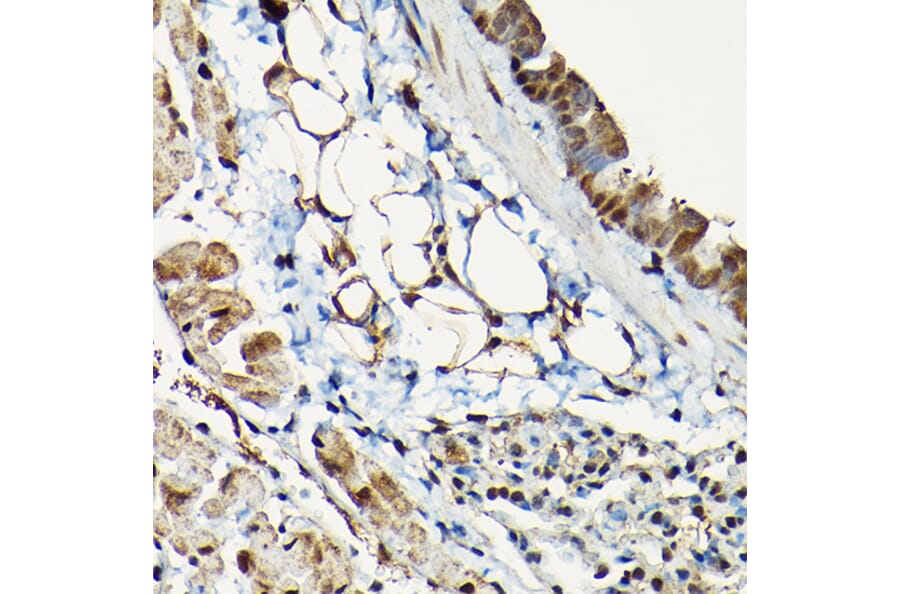 Immunohistochemistry - Anti-Smad2 Antibody (A93131) - Antibodies.com