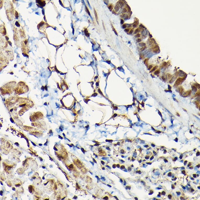 Immunohistochemistry - Anti-Smad2 Antibody (A93131) - Antibodies.com