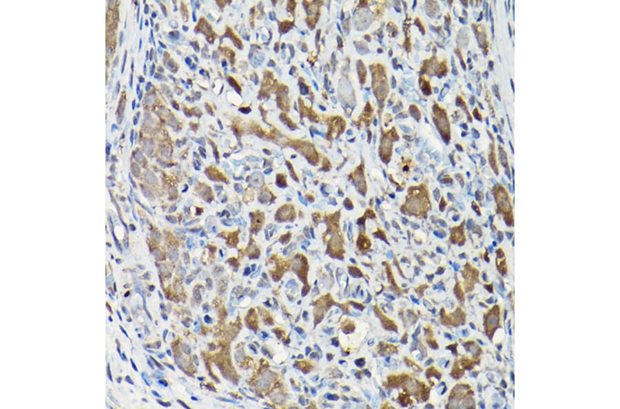 Immunohistochemistry - Anti-Smad2 Antibody (A93131) - Antibodies.com