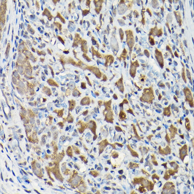 Immunohistochemistry - Anti-Smad2 Antibody (A93131) - Antibodies.com