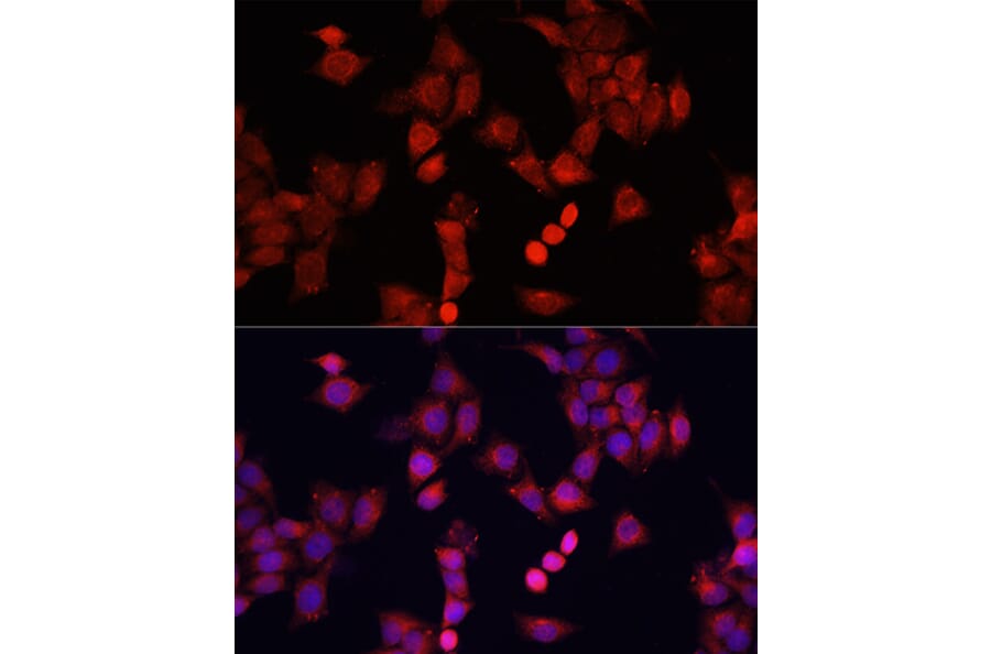 Immunofluorescence - Anti-Smad2 Antibody (A93131) - Antibodies.com