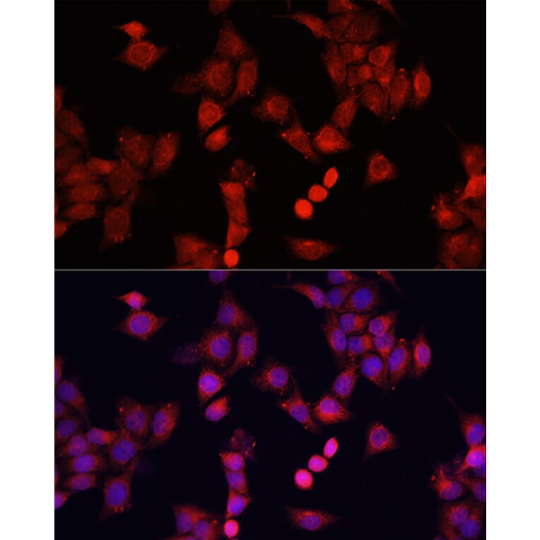 Immunofluorescence - Anti-Smad2 Antibody (A93131) - Antibodies.com