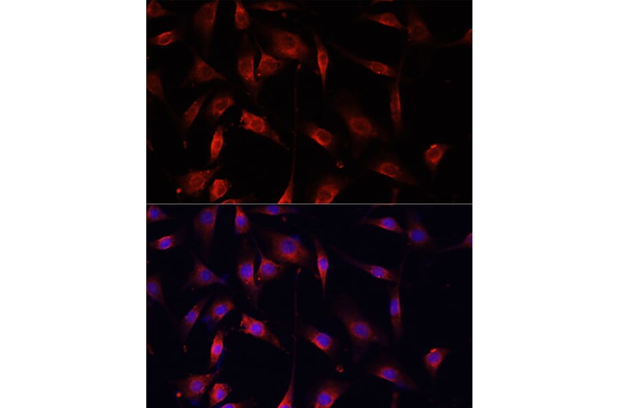 Immunofluorescence - Anti-Smad2 Antibody (A93131) - Antibodies.com