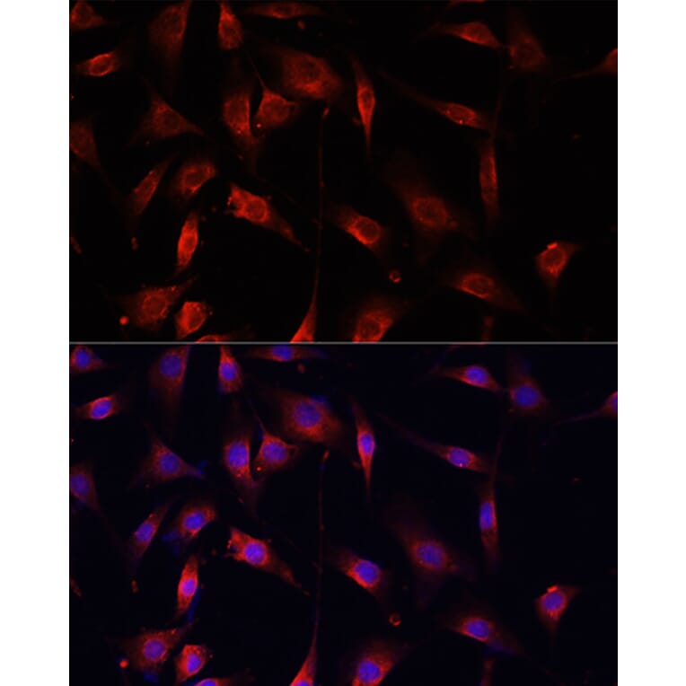 Immunofluorescence - Anti-Smad2 Antibody (A93131) - Antibodies.com