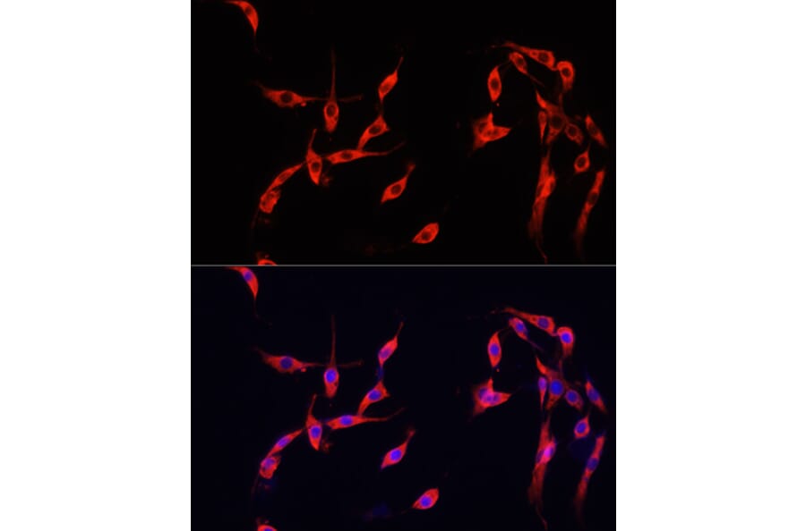 Immunofluorescence - Anti-Smad2 Antibody (A93131) - Antibodies.com