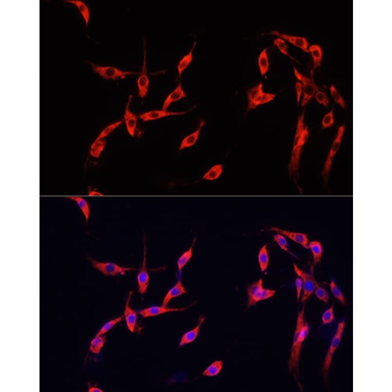 Immunofluorescence - Anti-Smad2 Antibody (A93131) - Antibodies.com