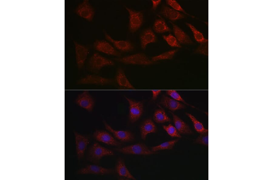 Immunofluorescence - Anti-Smad2 Antibody (A93131) - Antibodies.com