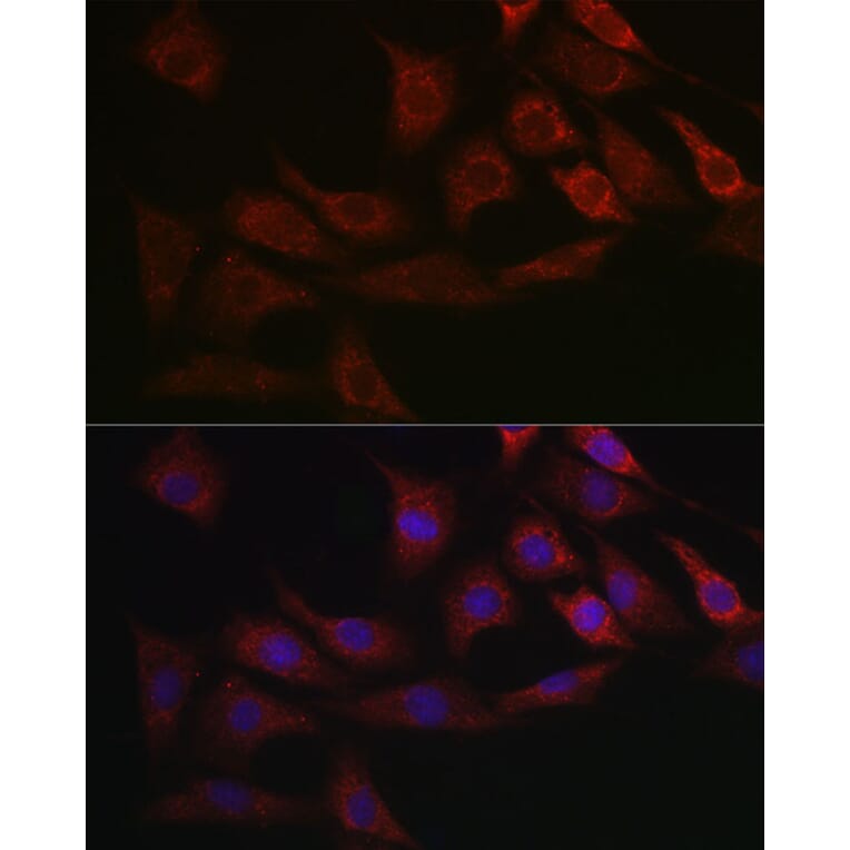 Immunofluorescence - Anti-Smad2 Antibody (A93131) - Antibodies.com