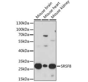 Western Blot - Anti-SRSF8 Antibody (A93132) - Antibodies.com