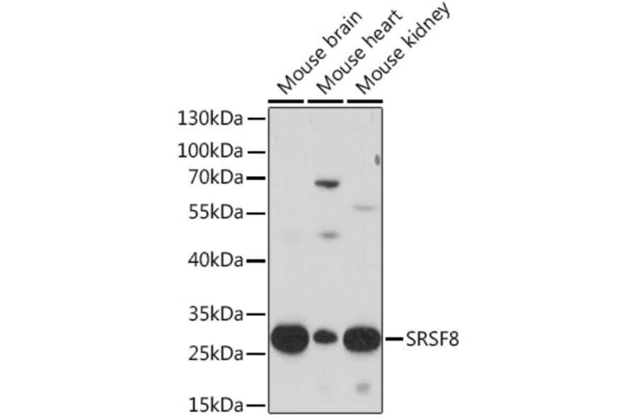 Western Blot - Anti-SRSF8 Antibody (A93132) - Antibodies.com
