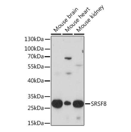 Western Blot - Anti-SRSF8 Antibody (A93132) - Antibodies.com