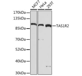 Western Blot - Anti-GPCR TAS1R2 Antibody (A93135) - Antibodies.com