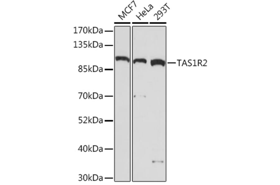 Western Blot - Anti-GPCR TAS1R2 Antibody (A93135) - Antibodies.com