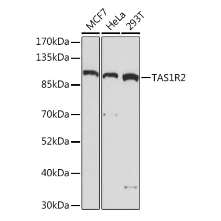 Western Blot - Anti-GPCR TAS1R2 Antibody (A93135) - Antibodies.com