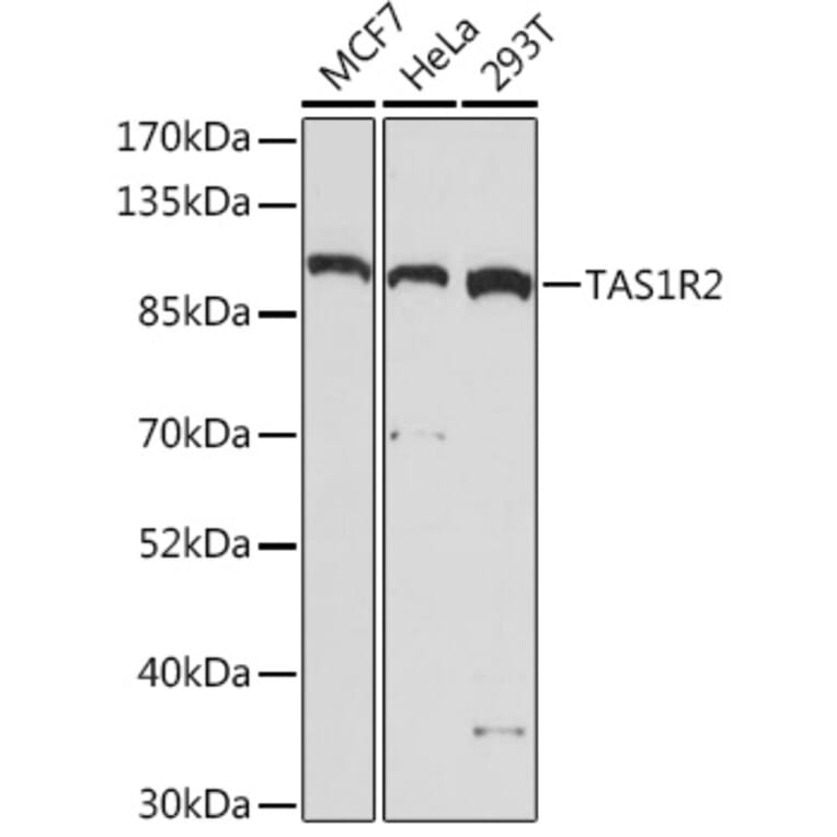Western Blot - Anti-GPCR TAS1R2 Antibody (A93135) - Antibodies.com