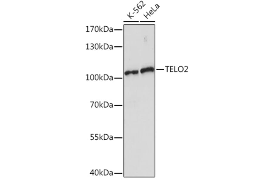 Western Blot - Anti-TELO2 Antibody (A93137) - Antibodies.com