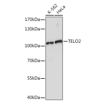 Western Blot - Anti-TELO2 Antibody (A93137) - Antibodies.com