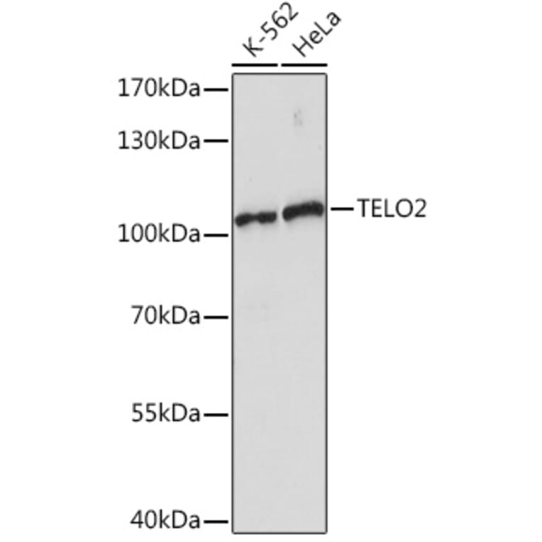 Western Blot - Anti-TELO2 Antibody (A93137) - Antibodies.com