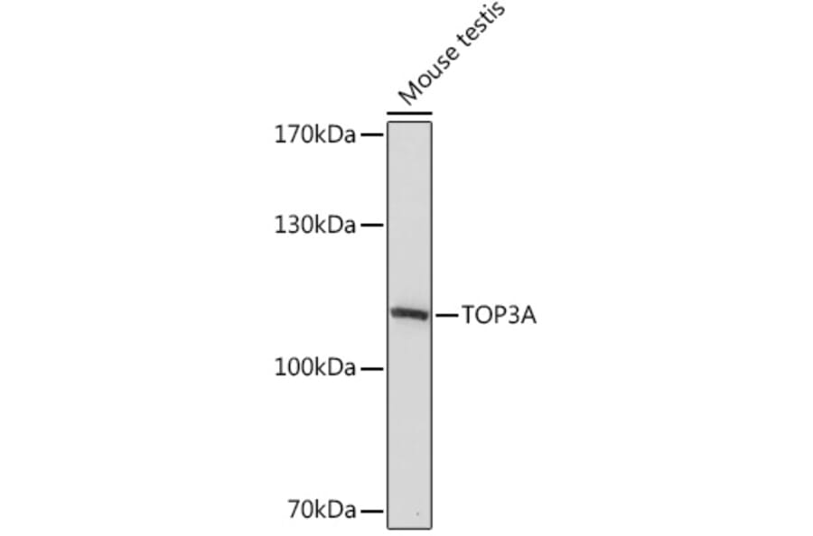 Anti Topoisomerase Iii Alpha Antibody A93139