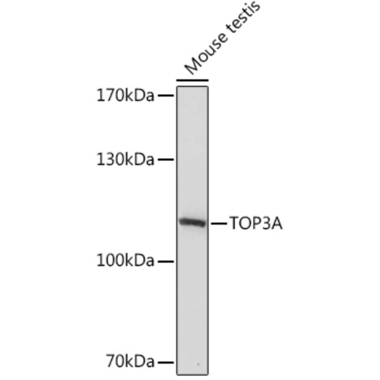 Western Blot - Anti-Topoisomerase III alpha Antibody (A93139) - Antibodies.com