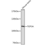 Western Blot - Anti-Topoisomerase III alpha Antibody (A93139) - Antibodies.com