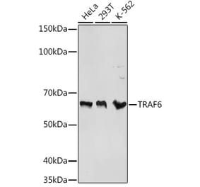 Western Blot - Anti-TRAF6 Antibody (A93140) - Antibodies.com