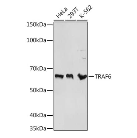 Western Blot - Anti-TRAF6 Antibody (A93140) - Antibodies.com