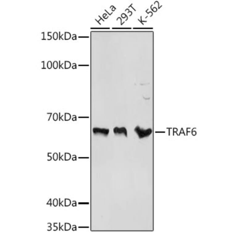 Western Blot - Anti-TRAF6 Antibody (A93140) - Antibodies.com