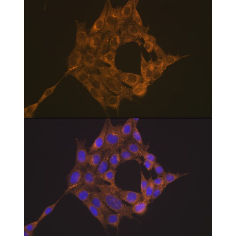 Immunofluorescence - Anti-TRAF6 Antibody (A93140) - Antibodies.com