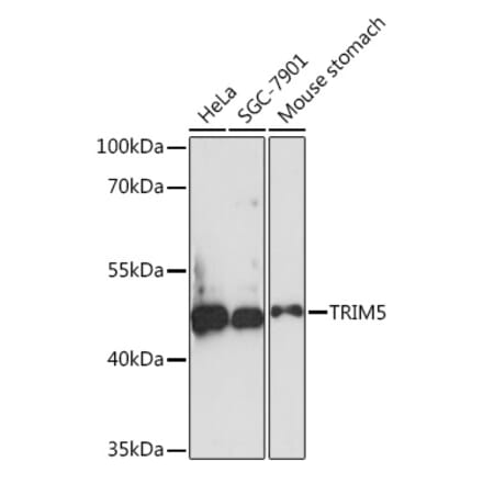 Western Blot - Anti-TRIM5 alpha Antibody (A93141) - Antibodies.com