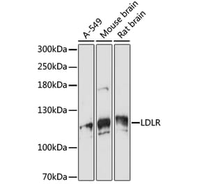 Western Blot - Anti-VPS18 Antibody (A93144) - Antibodies.com